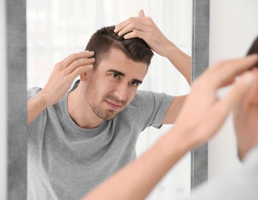 Generasi Milenial Lebih Cepat Botak, Ini Alasannya