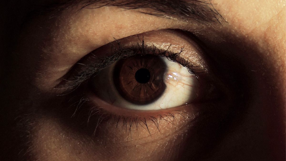Ada Selaput Putih di Bola Mata