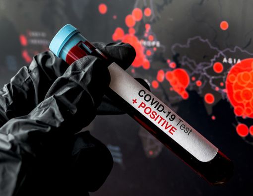 WHO: Semua Negara Selidiki Kasus Pertama Virus Corona di Wilayahnya!