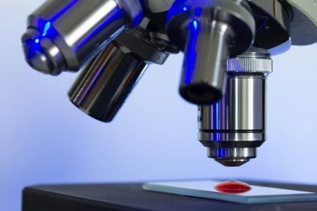 Ini Dia Perbedaan Thalassemia dengan Leukemia