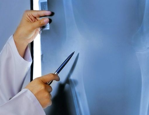 Metode-Metode untuk Mendiagnosis Kanker Tulang