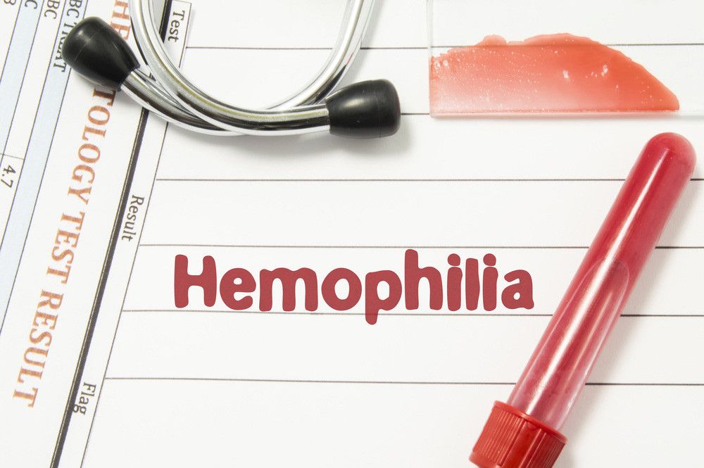 Benarkah Hemofilia Lebih Mudah Menyerang Pria?