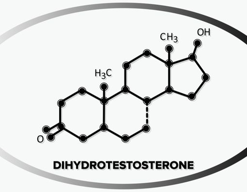 Ketahui Hubungan Dihidrotestosteron dan Kebotakan