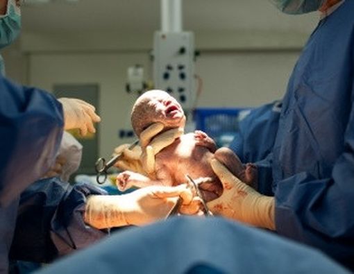 4 Sebab Dokter Anjurkan Kelahiran dengan Operasi Sesar