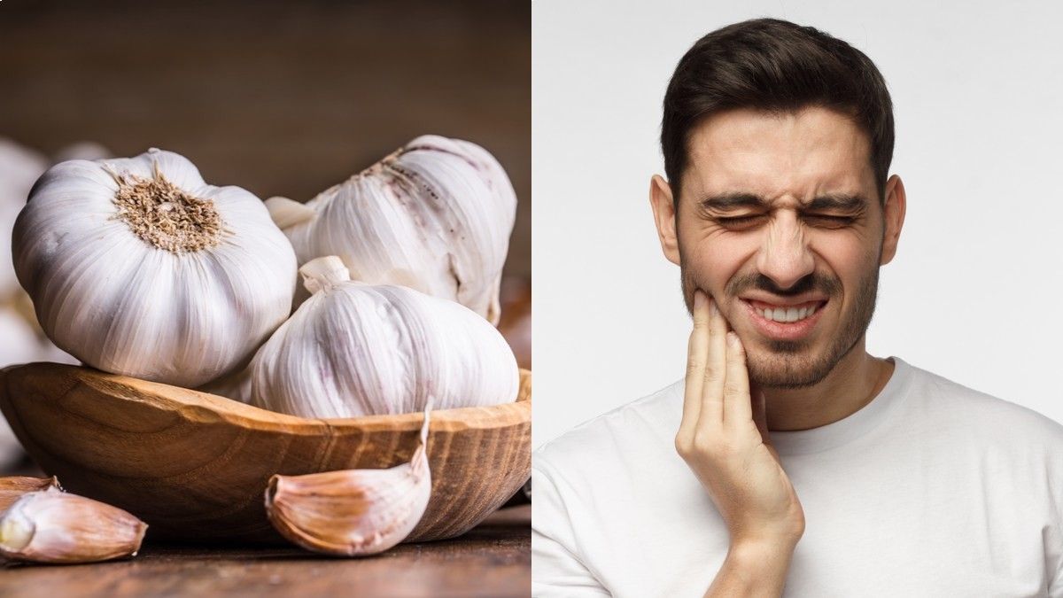 Mau Atasi Sakit Gigi dengan Bawang Putih, Cek Dulu Efektivitasnya