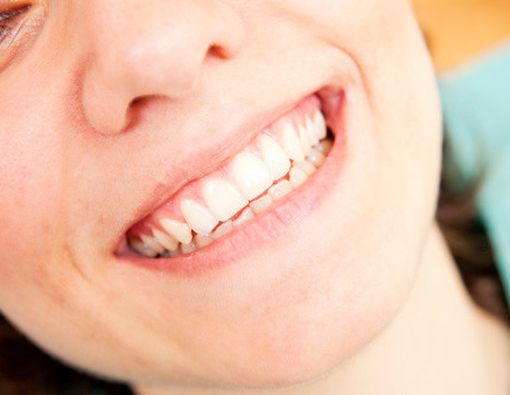 Atasi Gigi Ngilu Setelah Dental Bleaching