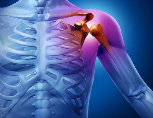 Baca Ini Jika Anda Sering Nyeri Sendi