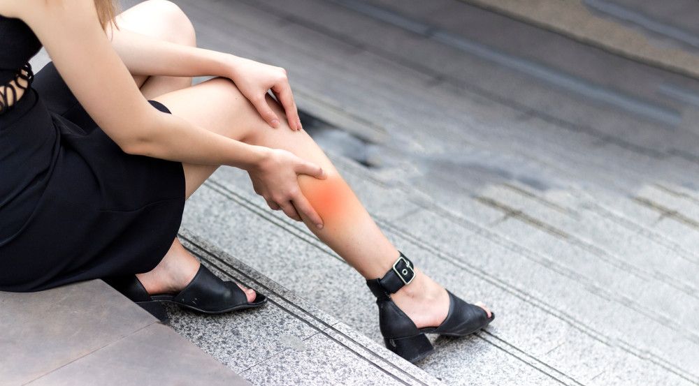 Kenali Gejala DVT yang Mengancam Nyawa