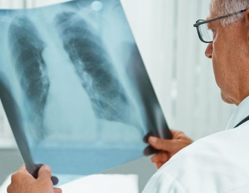 Kenali Perbedaan Paru-Paru Sehat dan Paru-Paru Perokok