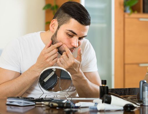 Benarkah Jerawat pada Pria Lebih Sulit untuk Sembuh?