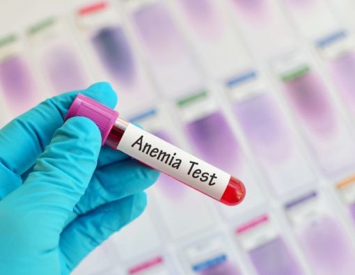 Anemia Tingkatkan Risiko Demam Berdarah, Mitos atau Fakta?