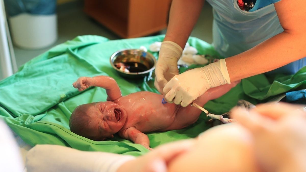 Mengenal Operasi Atresia Ani untuk Atasi Bayi yang Lahir Tanpa Anus