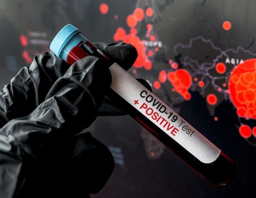 Takut Salah Sangka, Hindari Bandingkan Kasus Coronavirus di Negara Lain