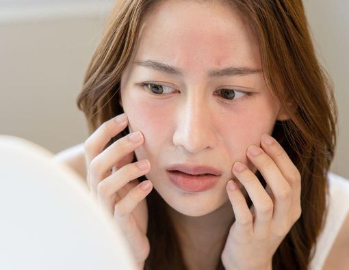 8 Faktor yang Sebabkan Perubahan Jenis Kulit