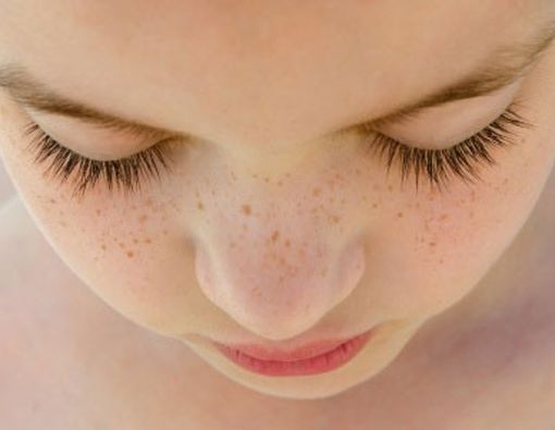 Cara Pudarkan Flek Hitam Tanpa Krim Wajah