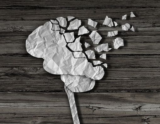 Sering Lupa Pertanda Apa?