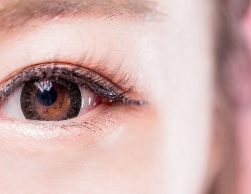 Arti Medis di Balik Warna dan Bentuk Belek Mata