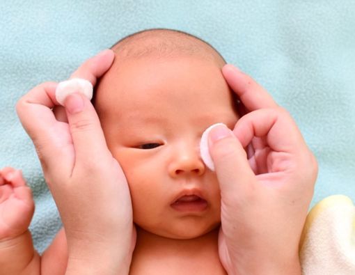 Mata Bayi Belekan Terus, Apa Penyebabnya?