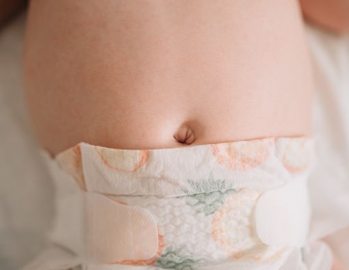 Pusar Bayi Ditempel Koin Agar Tidak Bodong, Mitos atau Fakta?