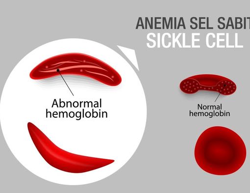 Hati-hati dengan Penyakit Keturunan yang Satu Ini
