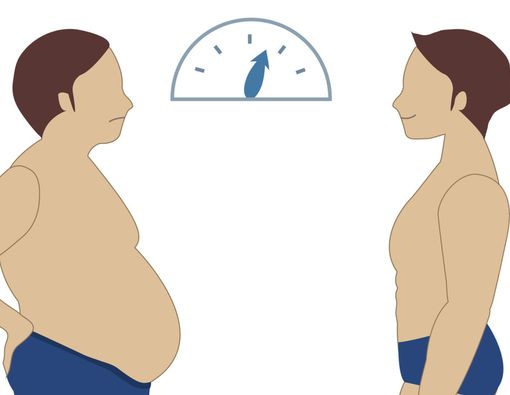 Penurunan Berat Badan Terlalu Cepat Picu Pembentukan Batu Empedu?