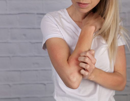 Atasi Alergi dengan Konsumsi 7 Makanan Ini