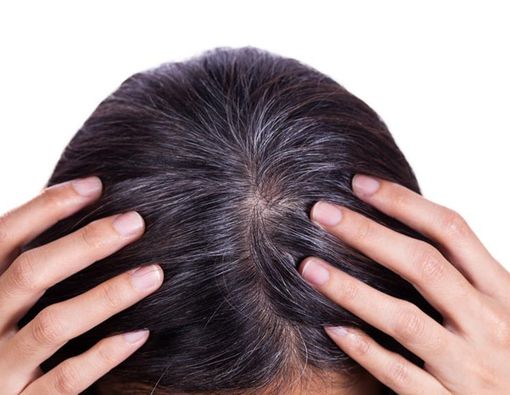 Uban di Usia Muda, Apa Sebabnya?