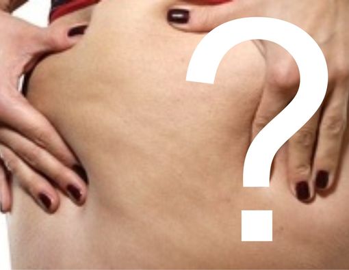 Mitos dan Fakta Seputar Selulit