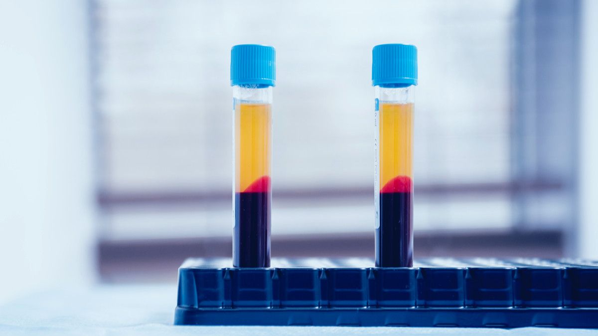 Manfaat Terapi Plasma Darah untuk Kecantikan
