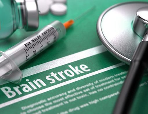 Waspadalah! Stroke Mengincar Usia Lebih Muda