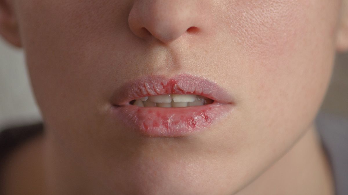 6 Cara Mengatasi Bibir Kering akibat Cuaca Panas Saat Ibadah Haji