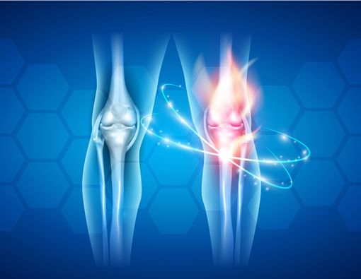 Kenali 5 Tanda Tulang Mulai Tidak Sehat