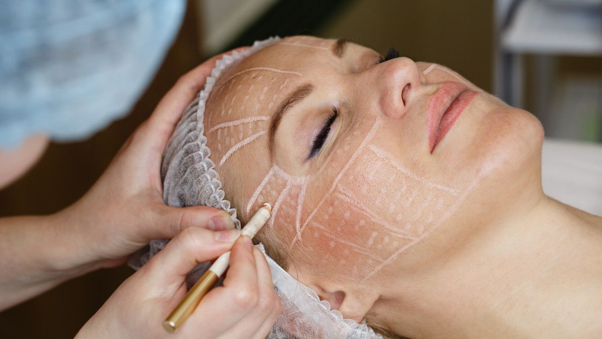 Mengenal Facelift, Prosedur yang Bikin Muda Kembali