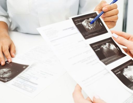 Wajib Tahu, Ini Perbedaan Kanker Ovarium dan Kista Ovarium