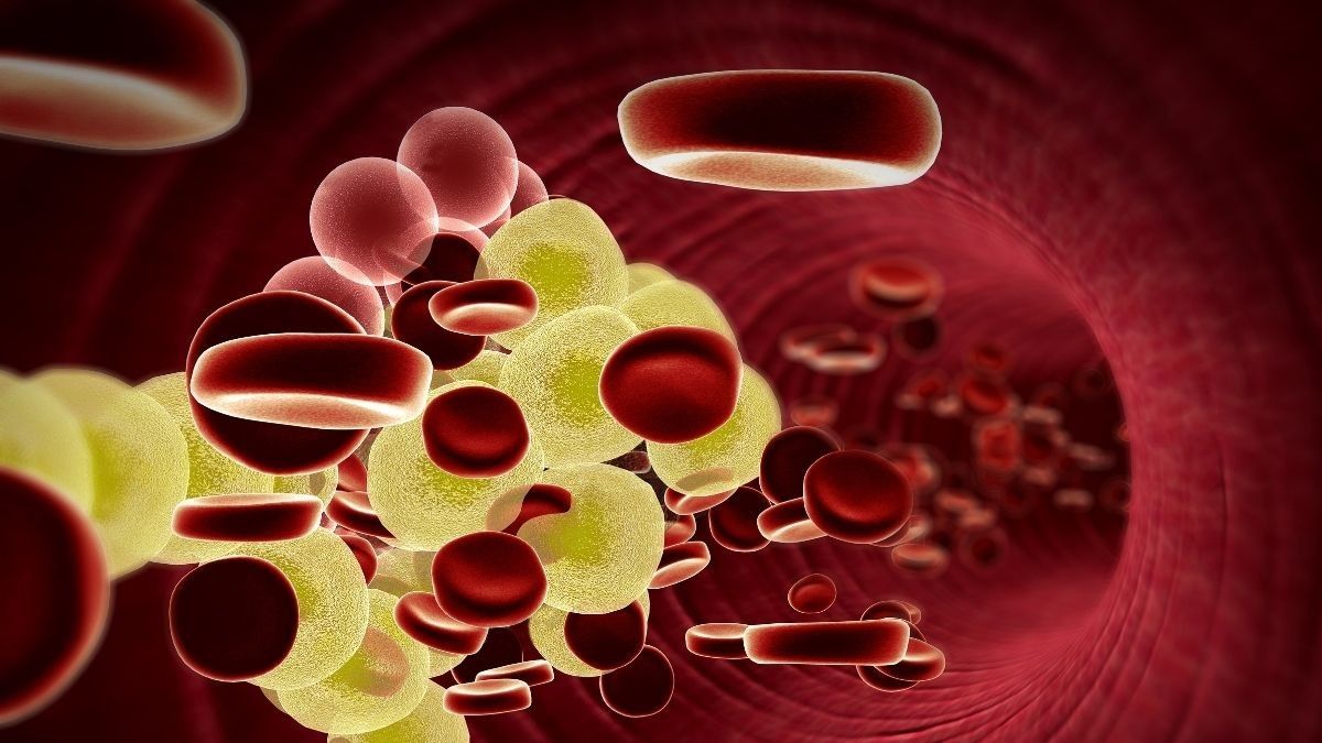 11 Daftar Penyakit yang Terkait Gangguan Kesehatan Pembuluh Darah