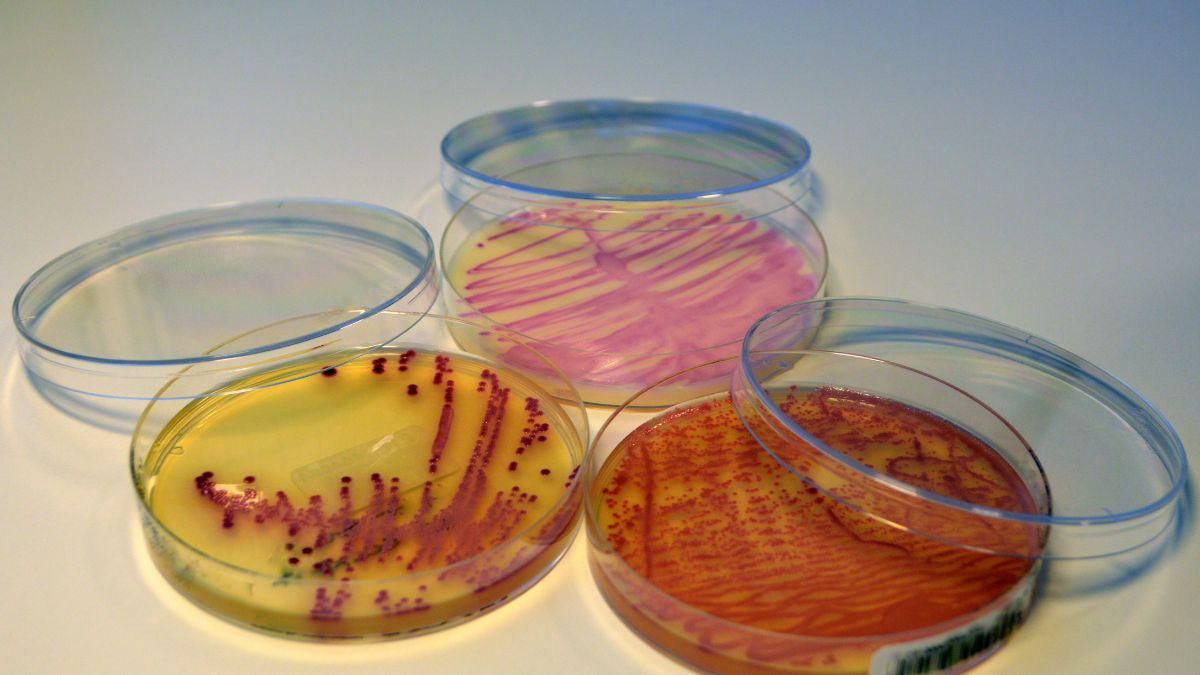 Fenomena Superbug yang Harus Diwaspadai