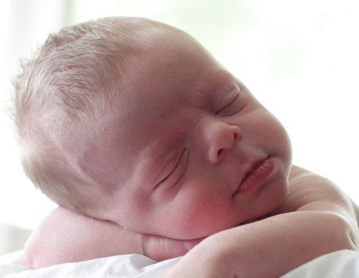 Bisakah Deteksi Dini Sindrom Williams Dilakukan?