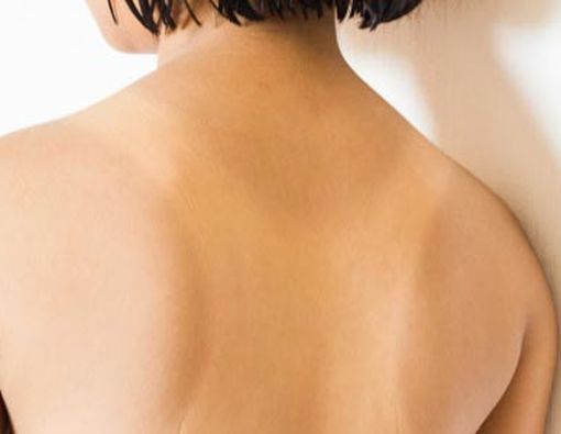 Dampak Buruk Sinar Matahari untuk Kulit