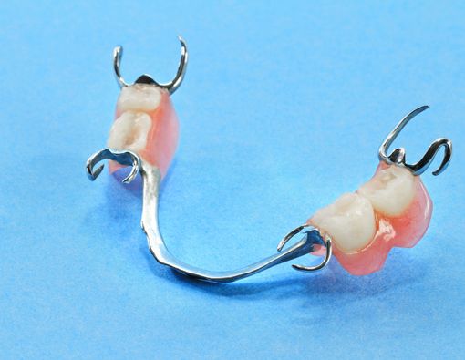 Dampak Penggunaan Gigi Palsu yang Tidak Sesuai