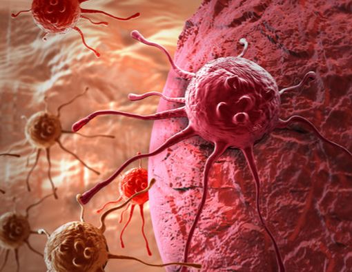 Benarkah Lebih Baik Kendalikan Kanker daripada Menghancurkannya?