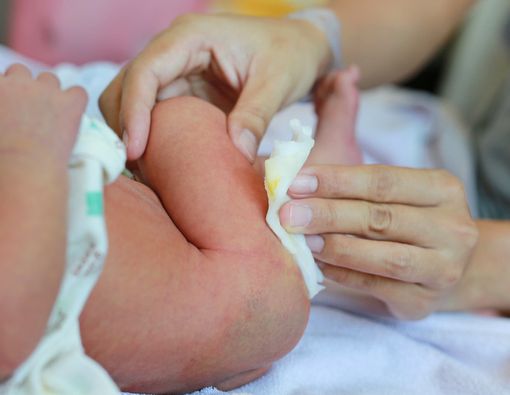 Agar Tak Panik, Cari Tahu Arti Warna Kotoran Bayimu