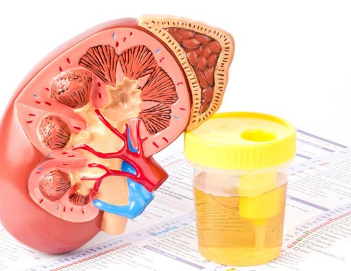 Inilah 3 Akibat Konsumsi Protein Berlebihan