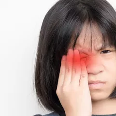 Rekomendasi Obat Sakit Mata Merah, Berair, dan Belekan Paling Ampuh di Apotek