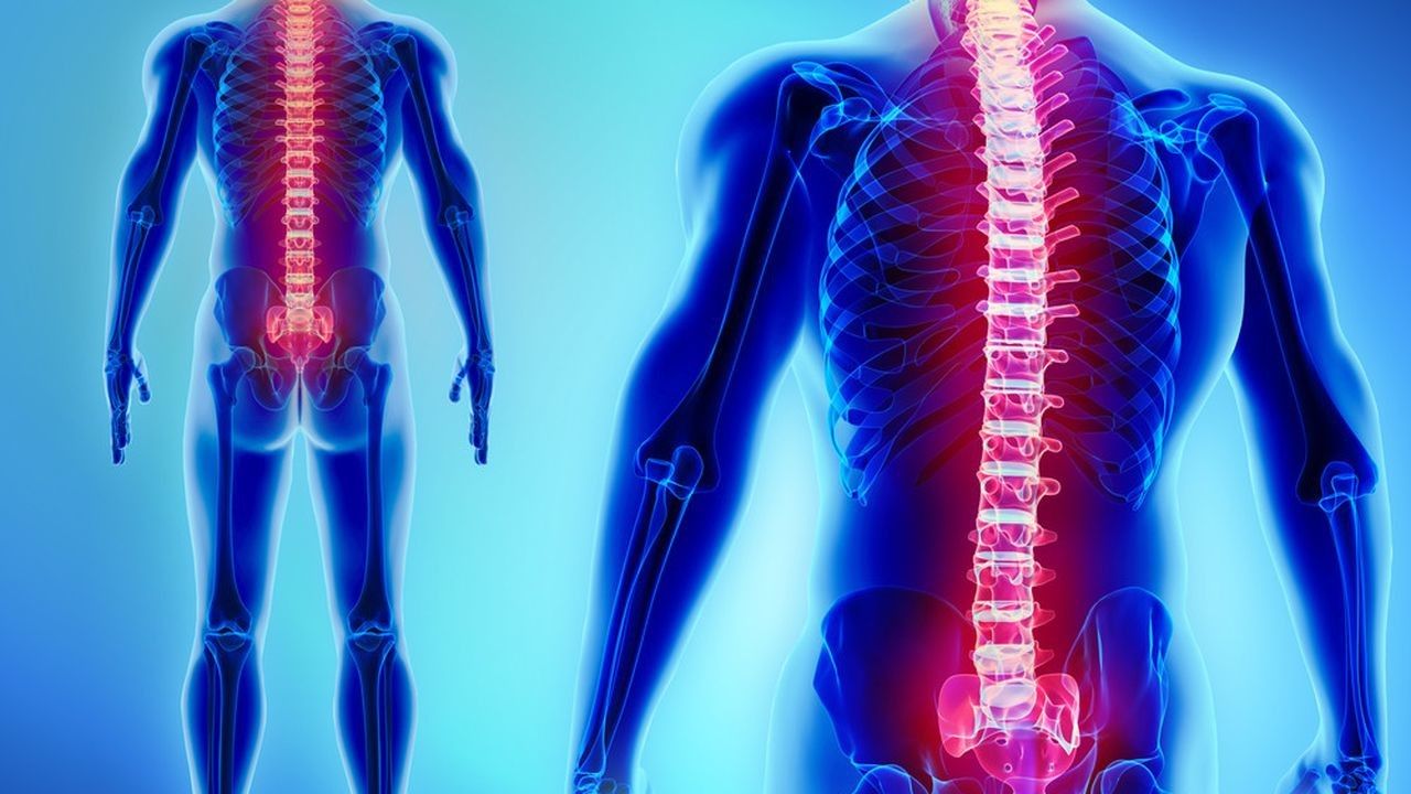 Diet Untuk Osteoporosis
