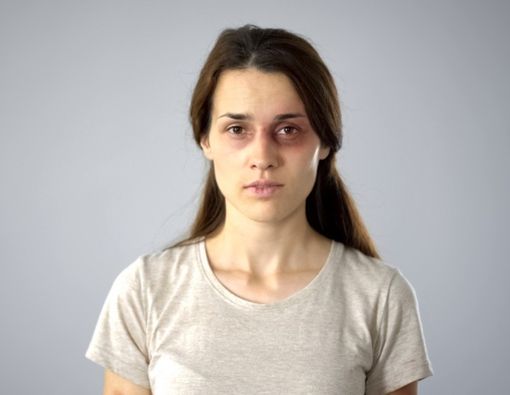 #Mugshotchallenge Bisa Ganggu Kesehatan Mental Korban Kekerasan