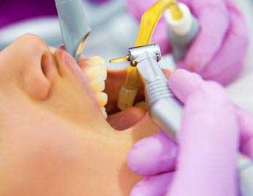 Mesin Bor Gigi Tanpa Rasa Sakit