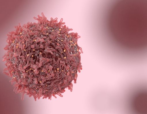 Ini Dia 10 Makanan yang Rentan Picu Kanker