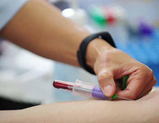 Mengenal Tes Estradiol, Pemeriksaan untuk Kesuburan Wanita