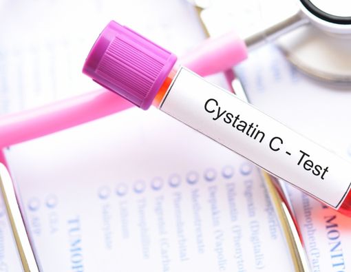 Tes Cystatin C untuk Mengetahui Gangguan Ginjal