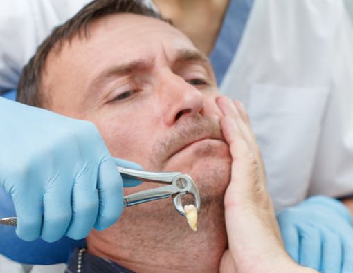 Penyebab Gigi Ngilu Setelah Dicabut?